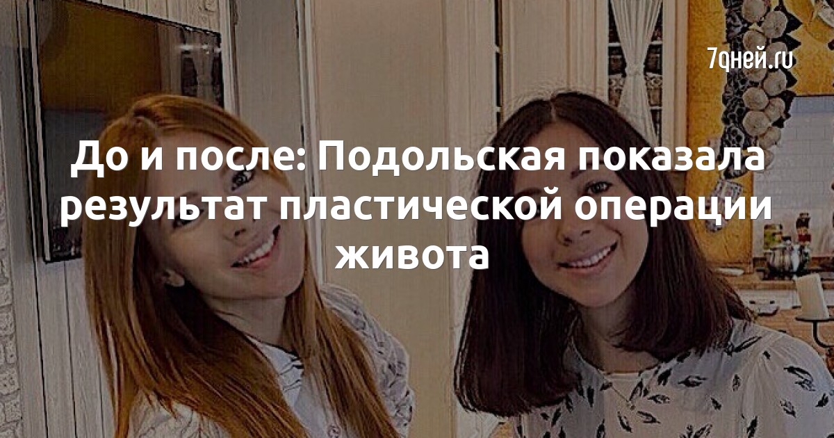 Наталья Подольская изменилась до неузнаваемости: что стало с лицом звезды?